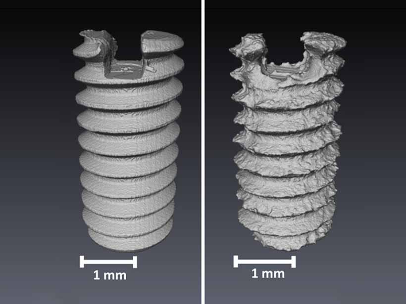 Gegenüberstellung einer Implantat-Schraube vor und nach der Verwendung