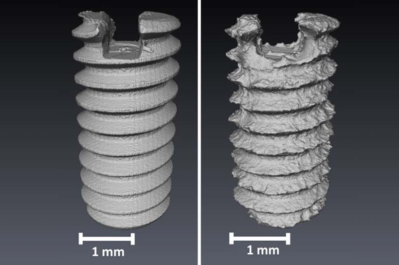 Gegenüberstellung einer Implantant-Schraube vor und nach der Verwendung.